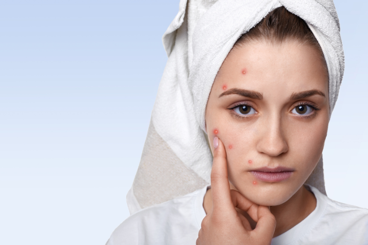 No momento, você está visualizando Celulite facial: infecção que exige atenção imediata