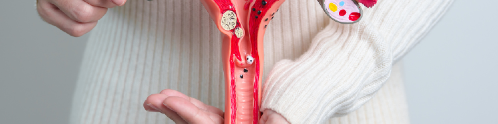 Endometriose